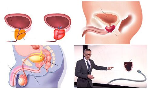 простата солим ва бемор