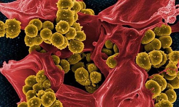 Staphylococcus aureus ҳамчун сабаби простатити бактериявӣ